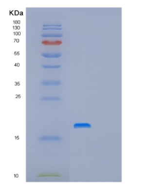 Recombinant Human PFDN4 Protein,Recombinant Human PFDN4 Protein