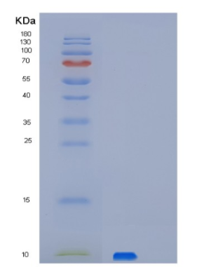 Recombinant Human PET117 Protein,Recombinant Human PET117 Protein