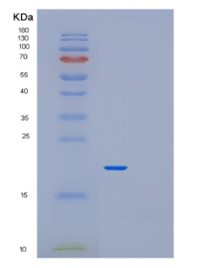 Recombinant Human PFDN2 Protein,Recombinant Human PFDN2 Protein