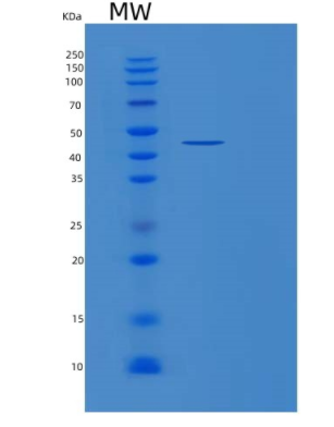 Recombinant Human PGK1 Protein,Recombinant Human PGK1 Protein