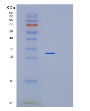 Recombinant Human PEX26 Protein,Recombinant Human PEX26 Protein