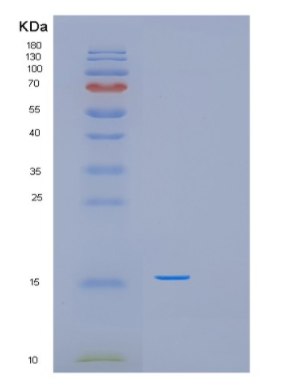 Recombinant Human PFDN6 Protein,Recombinant Human PFDN6 Protein