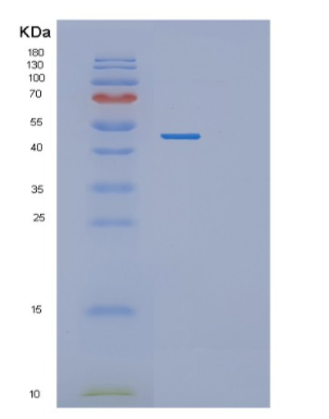 Recombinant Human PGK2 Protein,Recombinant Human PGK2 Protein