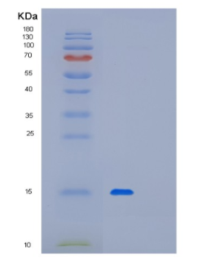 Recombinant Human PFDN1 Protein,Recombinant Human PFDN1 Protein