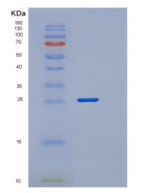 Recombinant Human PGLS Protein,Recombinant Human PGLS Protein