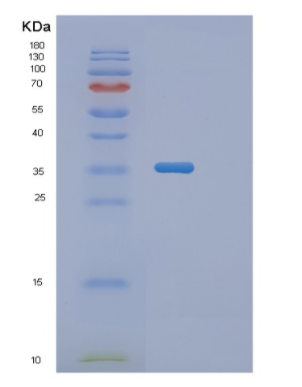 Recombinant Human PGP Protein,Recombinant Human PGP Protein