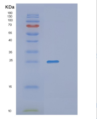 Recombinant Human PGP9.5 Protein,Recombinant Human PGP9.5 Protein