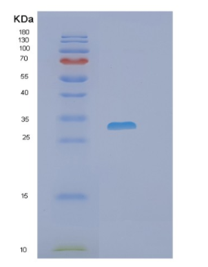 Recombinant Human PHOSPHO1 Protein,Recombinant Human PHOSPHO1 Protein