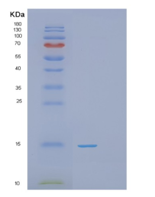 Recombinant Human PHPT1 Protein,Recombinant Human PHPT1 Protein