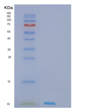 Recombinant Human PI3 Protein,Recombinant Human PI3 Protein