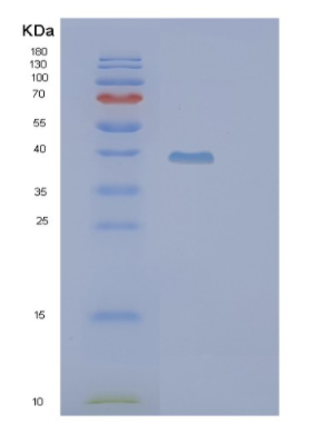 Recombinant Human PIH1D2 Protein,Recombinant Human PIH1D2 Protein