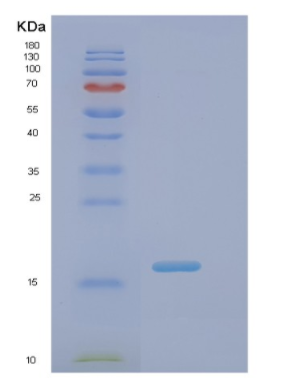 Recombinant Human Pin 1(Peptidyl-prolyl cis/trans isomerase) Human Protein,Recombinant Human Pin 1(Peptidyl-prolyl cis/trans isomerase) Human Protein
