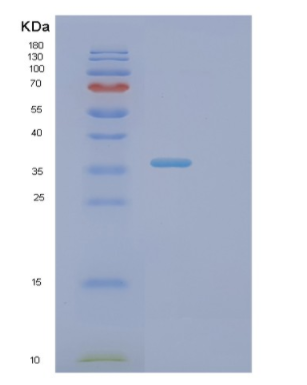 Recombinant Human PINK1 Protein,Recombinant Human PINK1 Protein