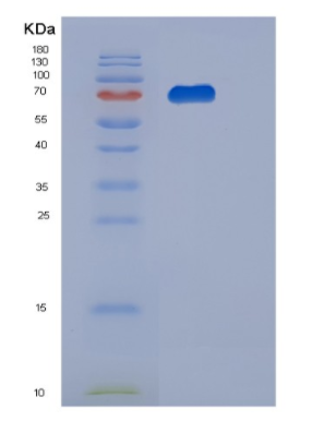 Recombinant Human PGM2 Protein,Recombinant Human PGM2 Protein