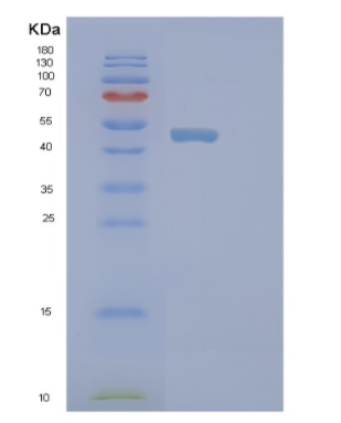 Recombinant Human PICK1 Protein,Recombinant Human PICK1 Protein