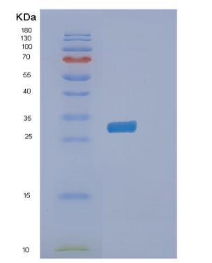 Recombinant Human PITPNB Protein,Recombinant Human PITPNB Protein