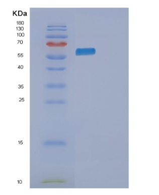 Recombinant Human PKLR Protein,Recombinant Human PKLR Protein