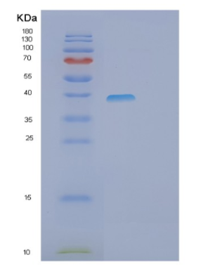 Recombinant Human PHF11 Protein,Recombinant Human PHF11 Protein