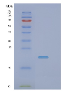 Recombinant Mouse Pin1 Protein,Recombinant Mouse Pin1 Protein