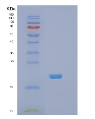 Recombinant Human PHLDA2 Protein,Recombinant Human PHLDA2 Protein