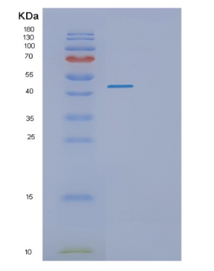 Recombinant Human PKNOX1 Protein,Recombinant Human PKNOX1 Protein