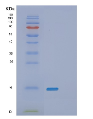 Recombinant Human PLAC8 Protein,Recombinant Human PLAC8 Protein