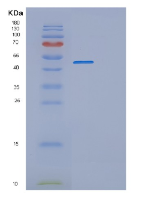 Recombinant Mouse Platelet glycoprotein 4 Protein,Recombinant Mouse Platelet glycoprotein 4 Protein