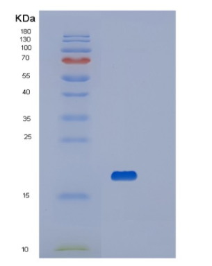 Recombinant Human Platelet receptor Gi24 Protein,Recombinant Human Platelet receptor Gi24 Protein