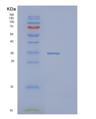 Recombinant Human PIH1D1 Protein,Recombinant Human PIH1D1 Protein