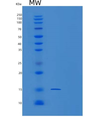 Recombinant Human PMP2 Protein,Recombinant Human PMP2 Protein