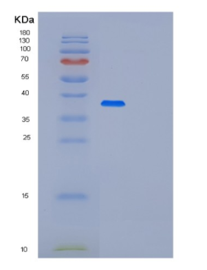 Recombinant Human PLCXD3 Protein,Recombinant Human PLCXD3 Protein