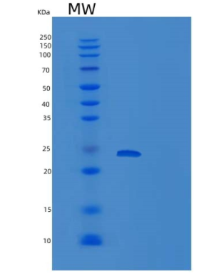 Recombinant Human PMVK Protein,Recombinant Human PMVK Protein