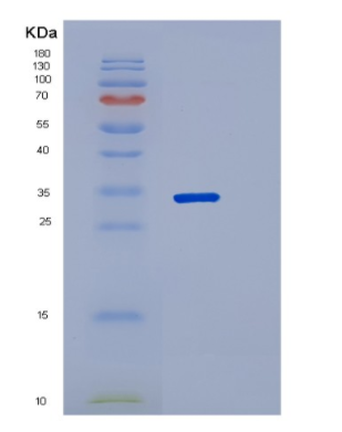 Recombinant Human PNP Protein,Recombinant Human PNP Protein