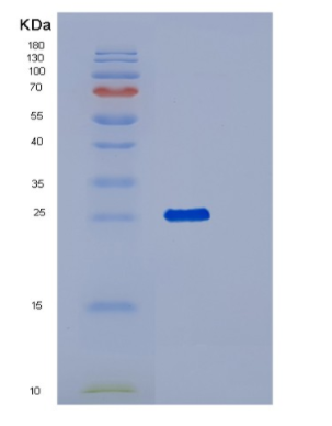 Recombinant Human PNPO Protein,Recombinant Human PNPO Protein