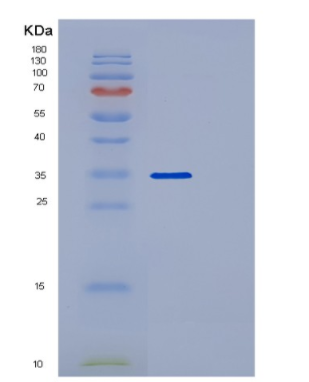 Recombinant Human POLR2C Protein,Recombinant Human POLR2C Protein