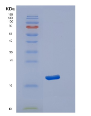 Recombinant Human POLR2D Protein,Recombinant Human POLR2D Protein