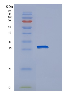 Recombinant Human POLR2E Protein,Recombinant Human POLR2E Protein