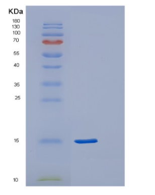 Recombinant Human POLR2F Protein,Recombinant Human POLR2F Protein