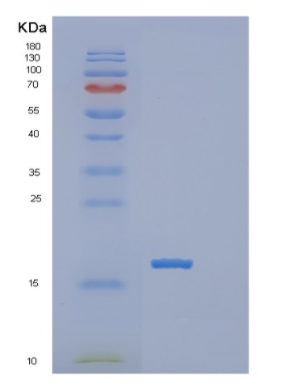 Recombinant Human POLR2I Protein,Recombinant Human POLR2I Protein