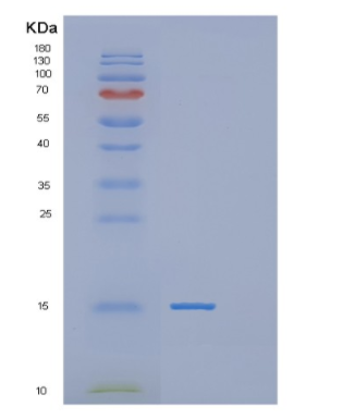 Recombinant Human POLR2J Protein,Recombinant Human POLR2J Protein