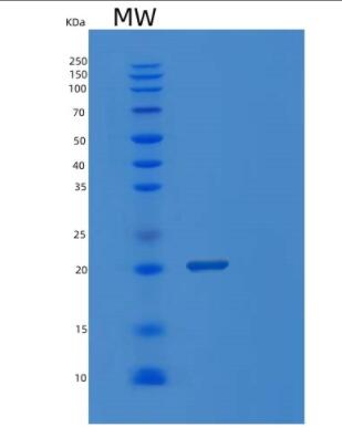 Recombinant E.coli ppa Protein,Recombinant E.coli ppa Protein