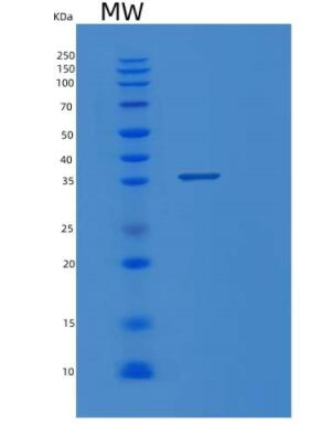 Recombinant Human PPA1 Protein,Recombinant Human PPA1 Protein