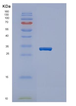 Recombinant Human PPARG Protein,Recombinant Human PPARG Protein