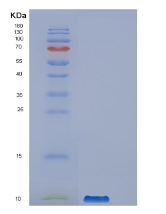 Recombinant Human PPBP Protein,Recombinant Human PPBP Protein