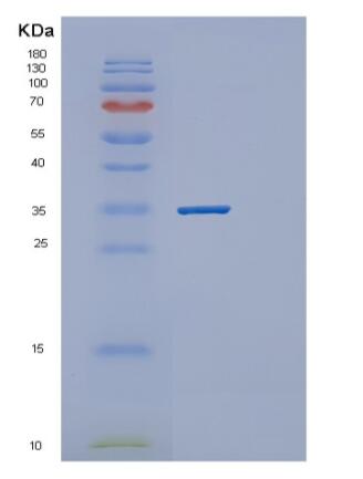 Recombinant Human PPCS Protein,Recombinant Human PPCS Protein