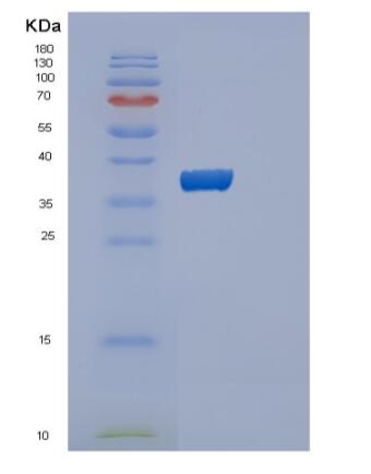 Recombinant Human PPIE Protein,Recombinant Human PPIE Protein