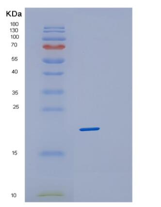 Recombinant Human PPP3R1 Protein,Recombinant Human PPP3R1 Protein