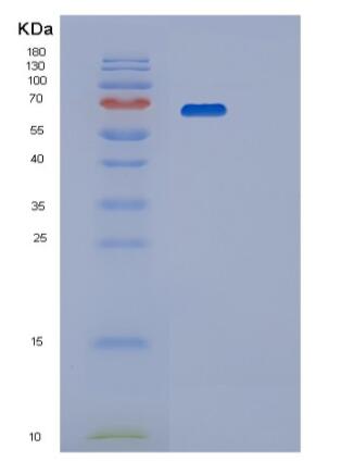 Recombinant Human PPP2R1A Protein,Recombinant Human PPP2R1A Protein