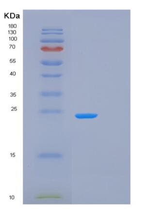 Recombinant Mouse Prdx1 Protein,Recombinant Mouse Prdx1 Protein