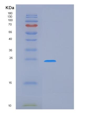 Recombinant Rat Prdx2 Protein,Recombinant Rat Prdx2 Protein